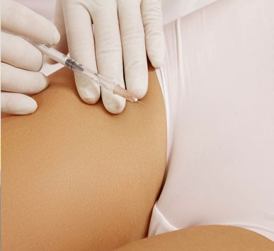 Vaginal Bleaching